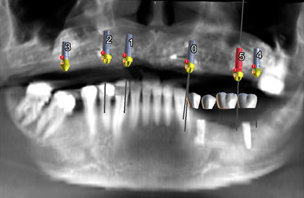 panoramica dental