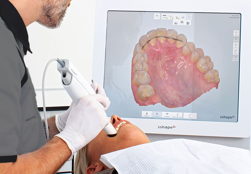 intra oral scanner madrid